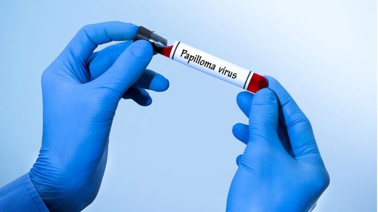 hpv-پاپیلوما-ویروس